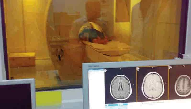 neuroradiologia tac_0