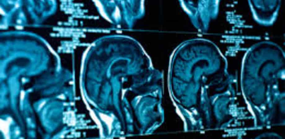 neuroradiologia_920x450