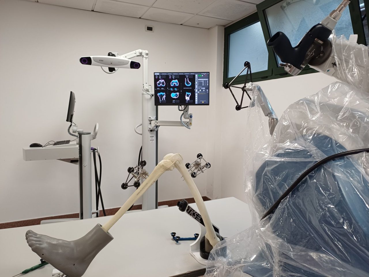 ROBOT-ORTOPEDICO-OSPEDALE-ARCO-1-1280x960.jpg